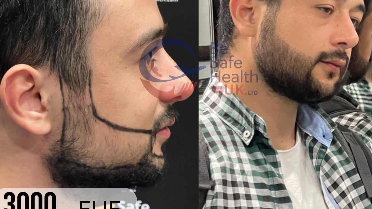 a809fecb-fcf3-4dd7-b48c-7814f3898a84-besafehealthukltd-gb-england-leeds-pudsey-fresha-1795237