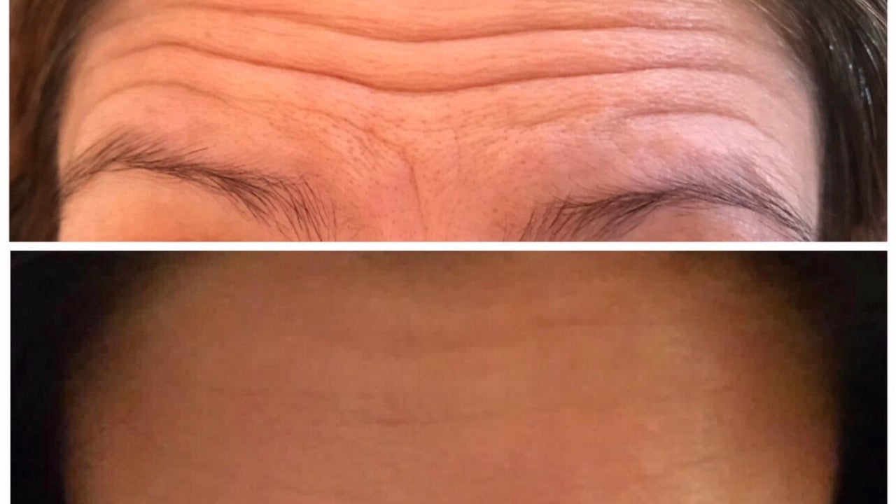 a814eb7e-b5e6-4dbd-b72f-e749ee194071-emaestheticsbishopsstortford-gb-england-greathallingbury-fresha-2912356