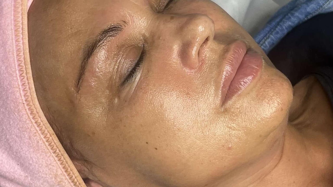 a8bdb57f-27ae-4dc7-8e96-6f5cb80baa40-envymeaestheticsbeauty-gb-england-scunthorpe-fresha-7197854