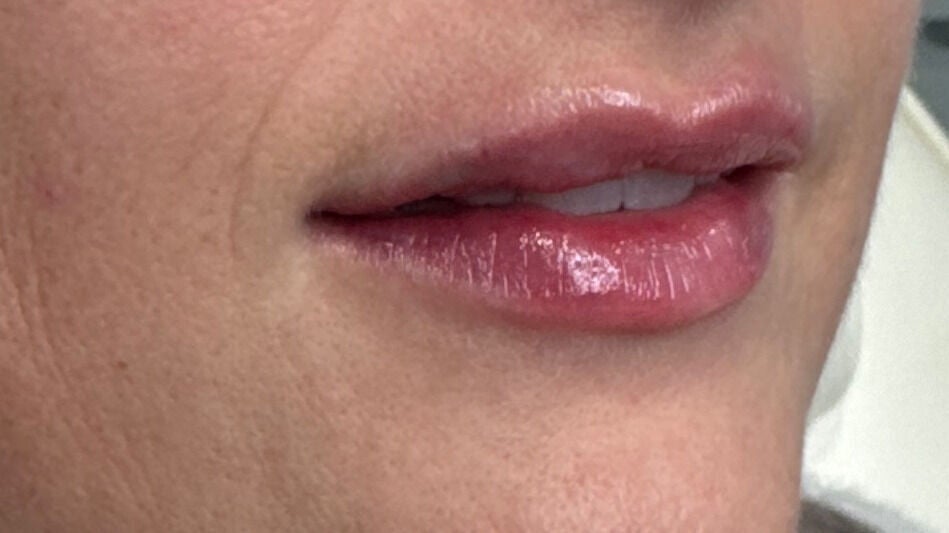 a9ba0a84-31be-4e4d-97a2-e148204334c1-aestheticsbydanie-gb-england-lowestoft-fresha-3052604