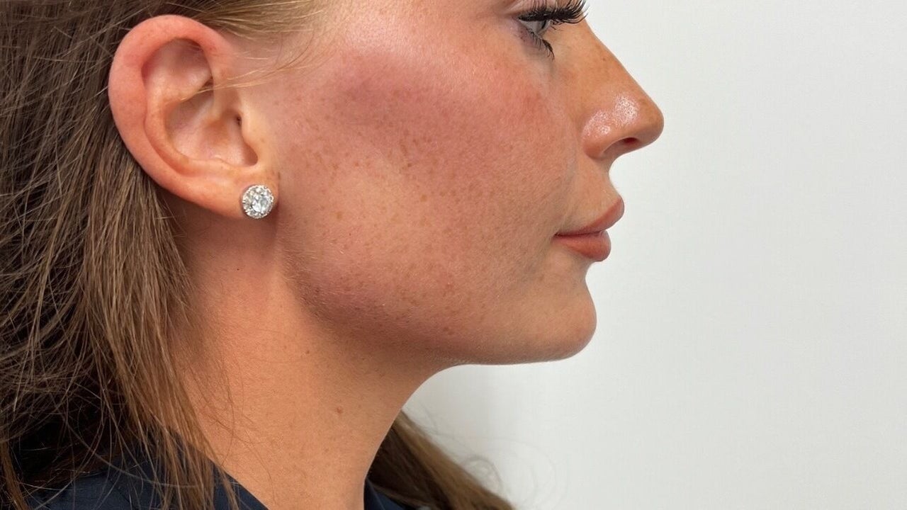 acd3dad8-9947-4df7-8b98-30a15b09240e-5771000