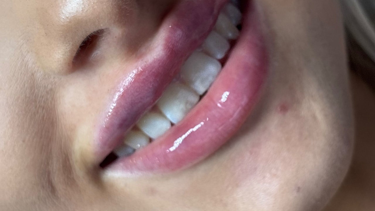 ad84e9af-11f6-48bc-bfed-c44206ae1cb5-angelicaestheticsandcosmetics-gb-england-canterbury-fresha-9935933