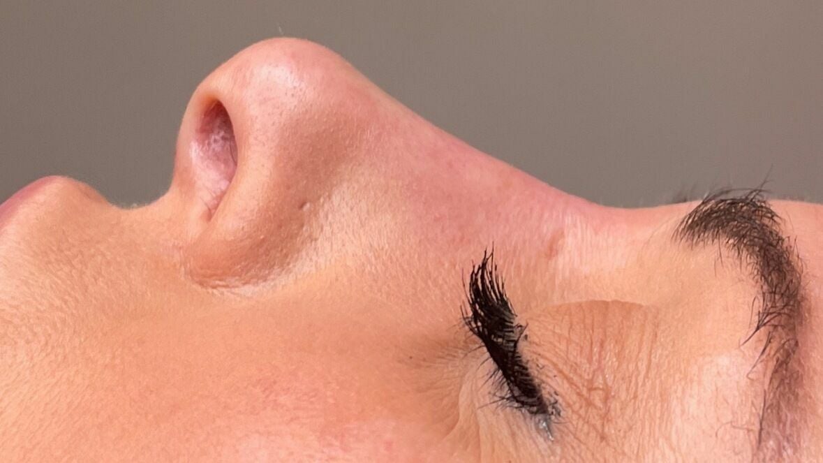 ae19e2d2-3014-4832-a564-885bf1e92741-chapter25aesthetics-bexley-gb-london-albanypark-fresha-5876607