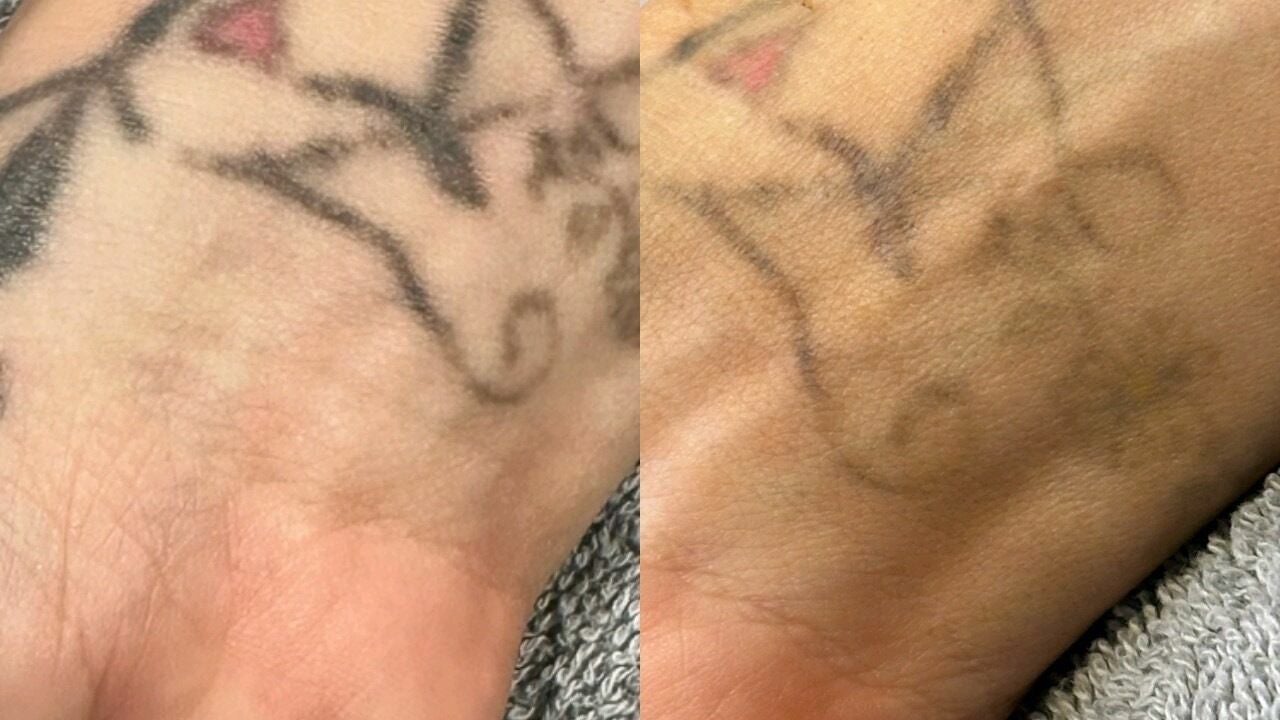 aefc9ea3-19c8-4f71-a015-59c59ceeeedf-lushlaserskin-gb-england-witham-fresha-4211738