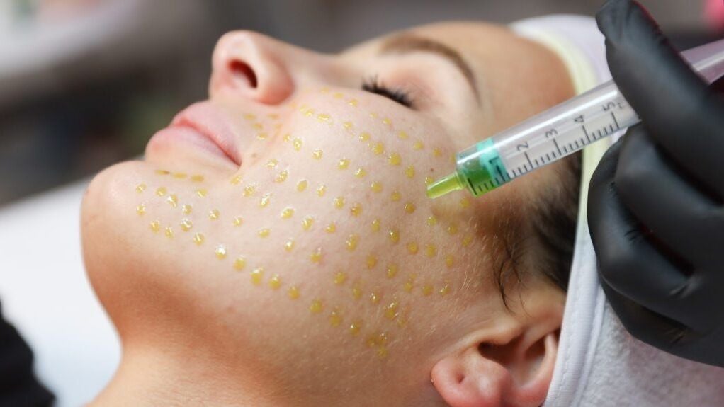 af53bce2-db59-4a1d-a70c-afb0f58bc840-ahnurseaestheticsatthestablesbeautyskinclinic-gb-england-ackworth-fresha-6380745