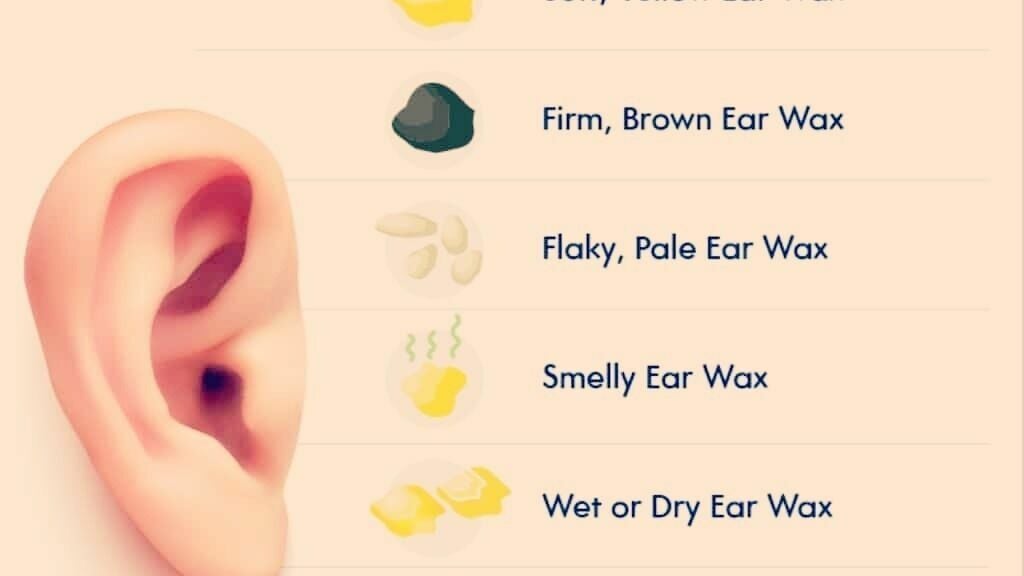 b1776bb0-bced-4089-8e7a-acaa306f94b8-havenhearingcare-gb-england-kennett-fresha-8455652