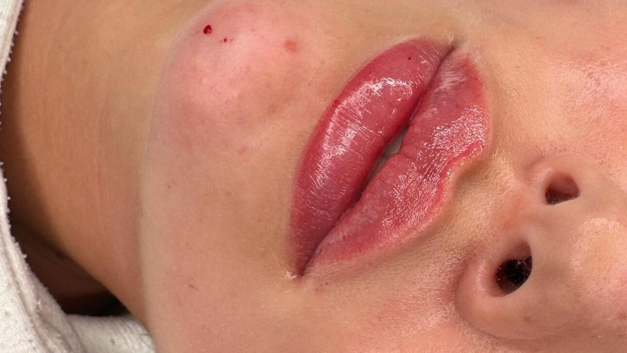 b2527dbf-3c75-4115-b54e-8a5386b1e49e-reenuaesthetics-gb-england-lichfield-fresha-7492630