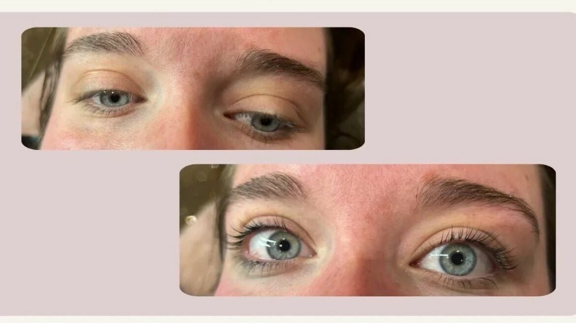 b260a028-0726-483b-b6d2-51fee24d796a-freshglowaesthetics-gb-england-cheslynhay-cheslynhay-fresha-9135614