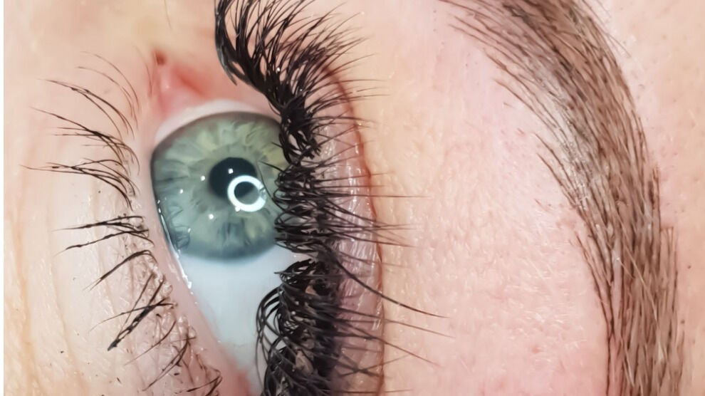 b2be4c13-cf0b-48cb-b32e-6debfd7dedcb-npaestheticsbeautyclinic-gb-england-maidstone-allington-fresha-7658372