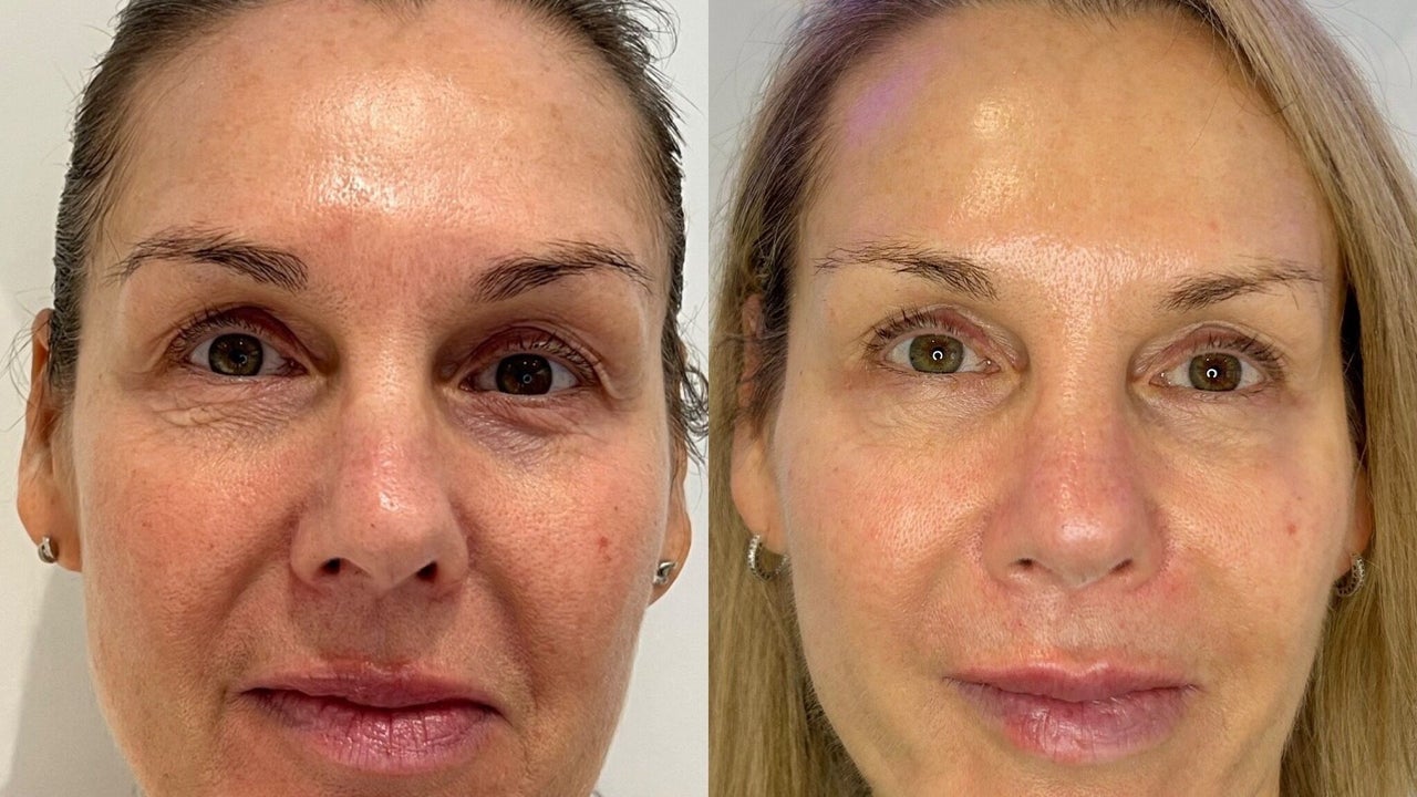 b3dc1e01-779f-475b-9a6b-77ca063eed3a-kentbeautyandaesthetics-gb-tunbridgewells-fordcombe-fresha-8437629