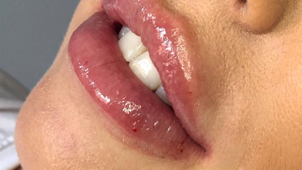 b6910019-3f31-4960-b40f-4bc34947ae0b-jessicajaneaesthetics-gb-england-chesterfield-fresha-7953098