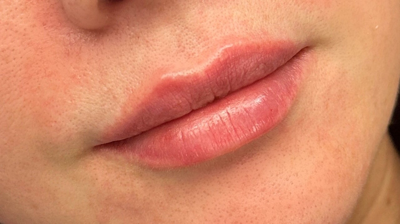 b8b4bf32-5530-495d-aefc-74c10bc50b0b-anatomicaaestheticsamyyoungbscfdscbieassoc-gb-scotland-glasgow-dalmarnock-fresha-1730451