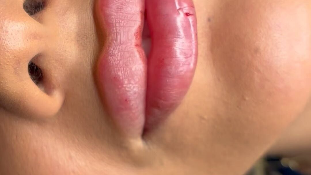 b9d4d5a8-b40d-4667-bc36-5eed659a1b8c-bellamacaestheticsmanchester-gb-england-tyldesley-manchester-fresha-1833490