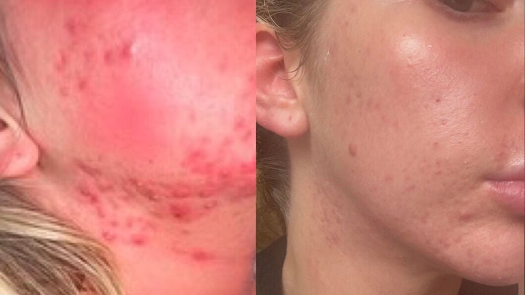 bd15dd54-a709-42b1-a8ae-c224782e0b91-skinrestresults-gb-england-sheffield-stannington-fresha-6219694