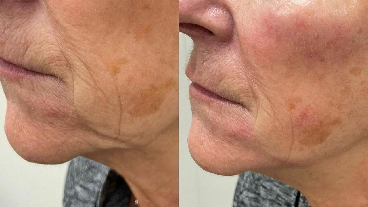 c12ff25a-0dfb-4221-8bbb-d756d1972def-debutaestheticsclinic-gb-england-wickford-fresha-5124817