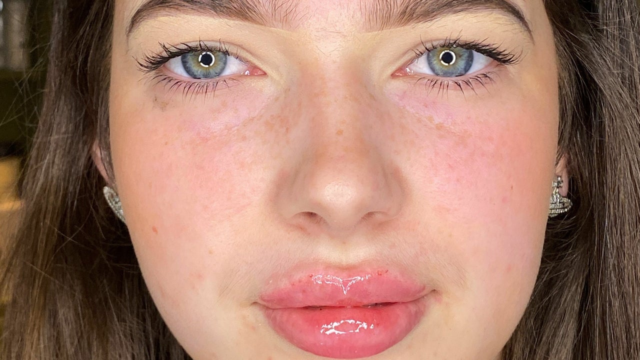 c1c63016-d3af-4d4e-b2fc-e85e7aac7665-greenhouseaesthetics-gb-england-sevenoaks-fresha-6139843