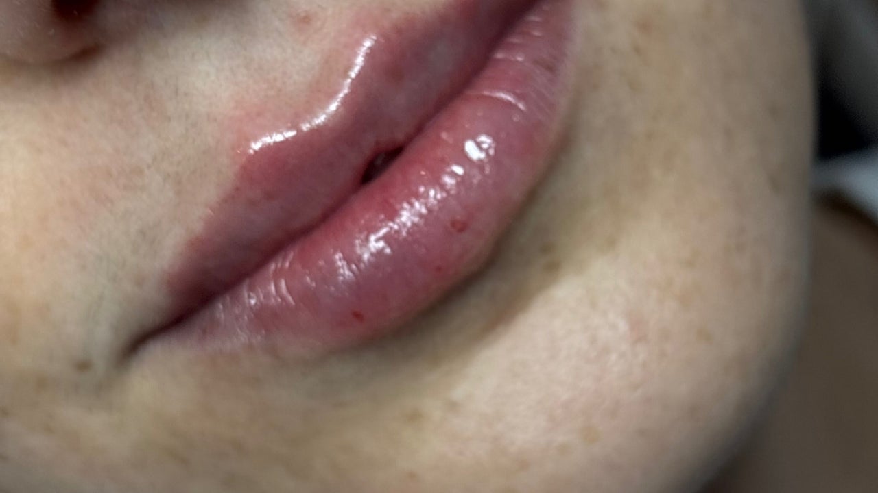 c4bf1a25-dd64-4cea-b9b0-bb43f1a4738d-angelicaestheticsandcosmetics-gb-england-canterbury-fresha-8726514