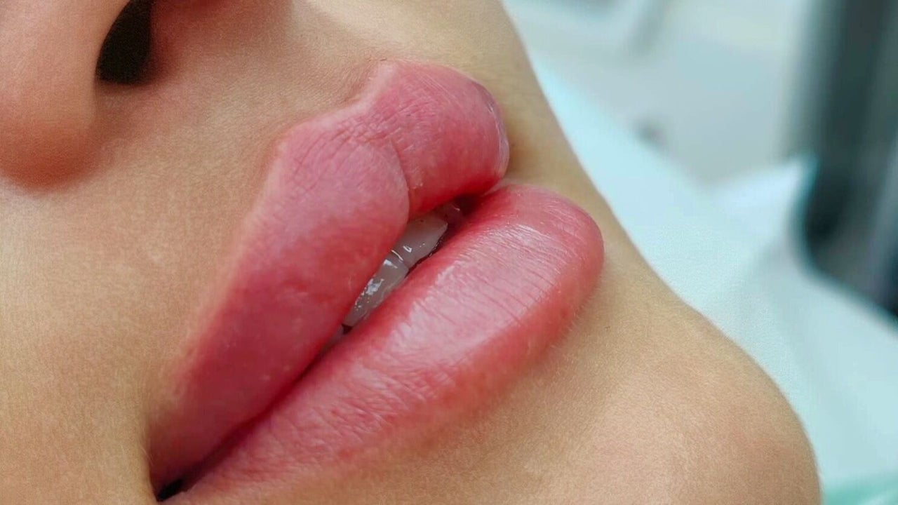 c5418e51-3a30-41a6-a6eb-f5ad75408205-8523312