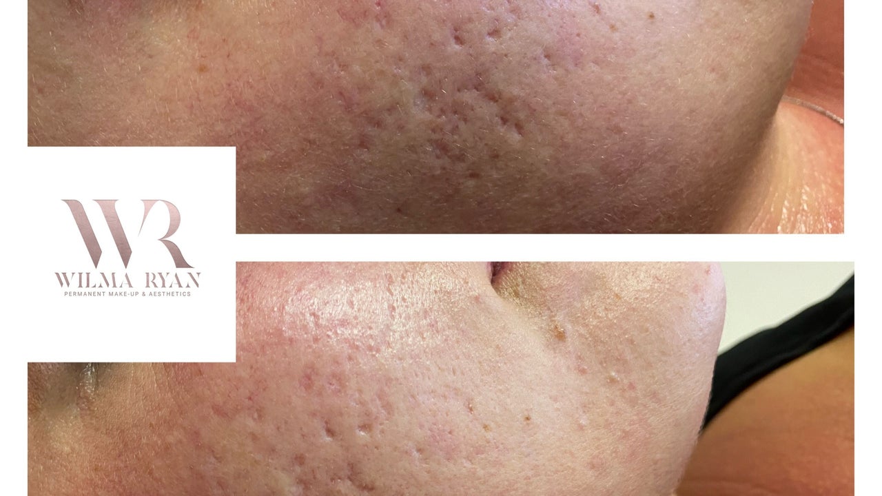 c871fe6d-83e7-417c-8cc5-b0e158d3a7cd-wilmaryanpermanentmakeupandaesthetics-gb-england-ryde-basedinanthonylinhartthesalon-fresha-3367389