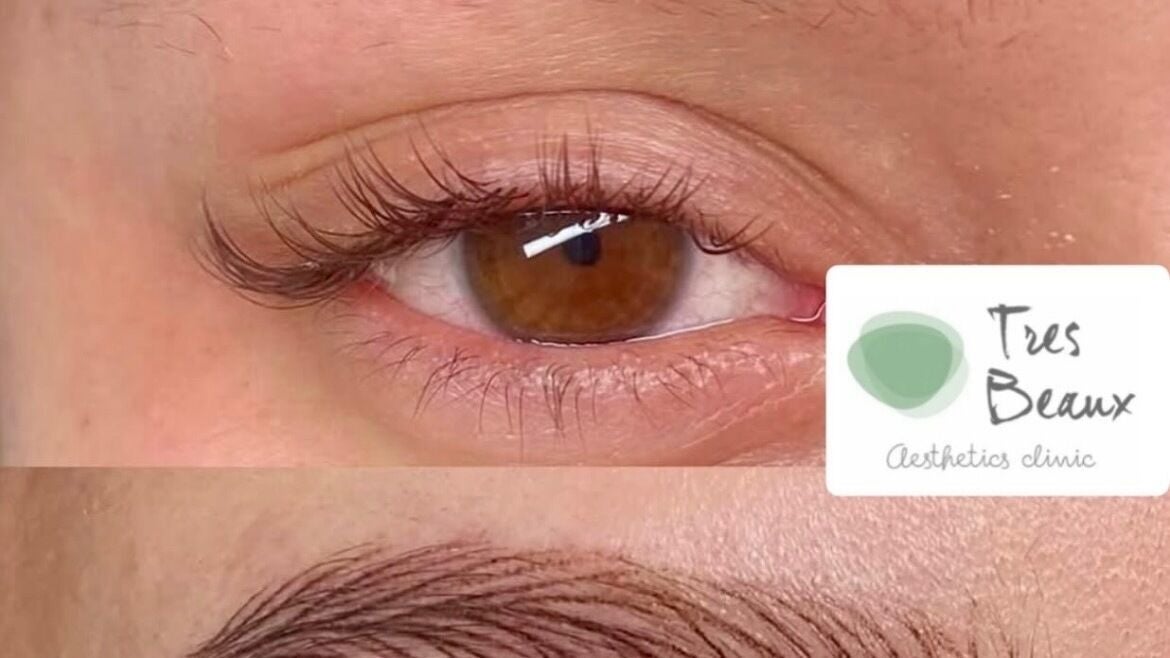 c9072998-8443-48fe-b29a-0e5d239169b8-tresbeauxaesthetics-gb-england-birmingham-kingsnorton-fresha-2158867