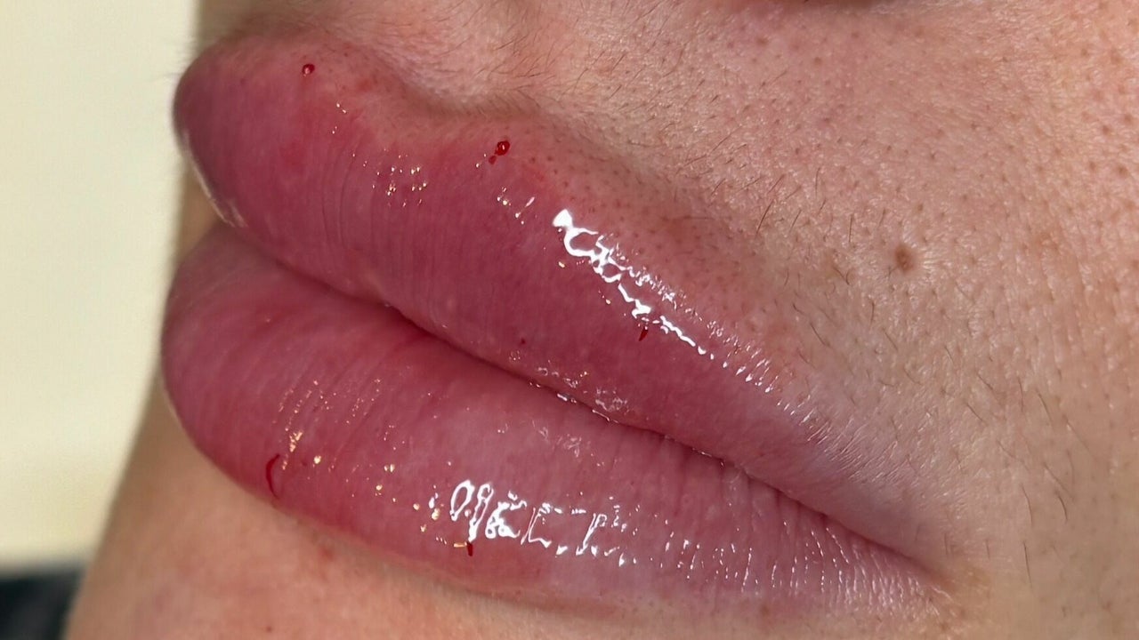 cb2a3862-5ed4-4bde-96e3-8b580801d0d9-greenhouseaesthetics-gb-england-sevenoaks-fresha-5597946