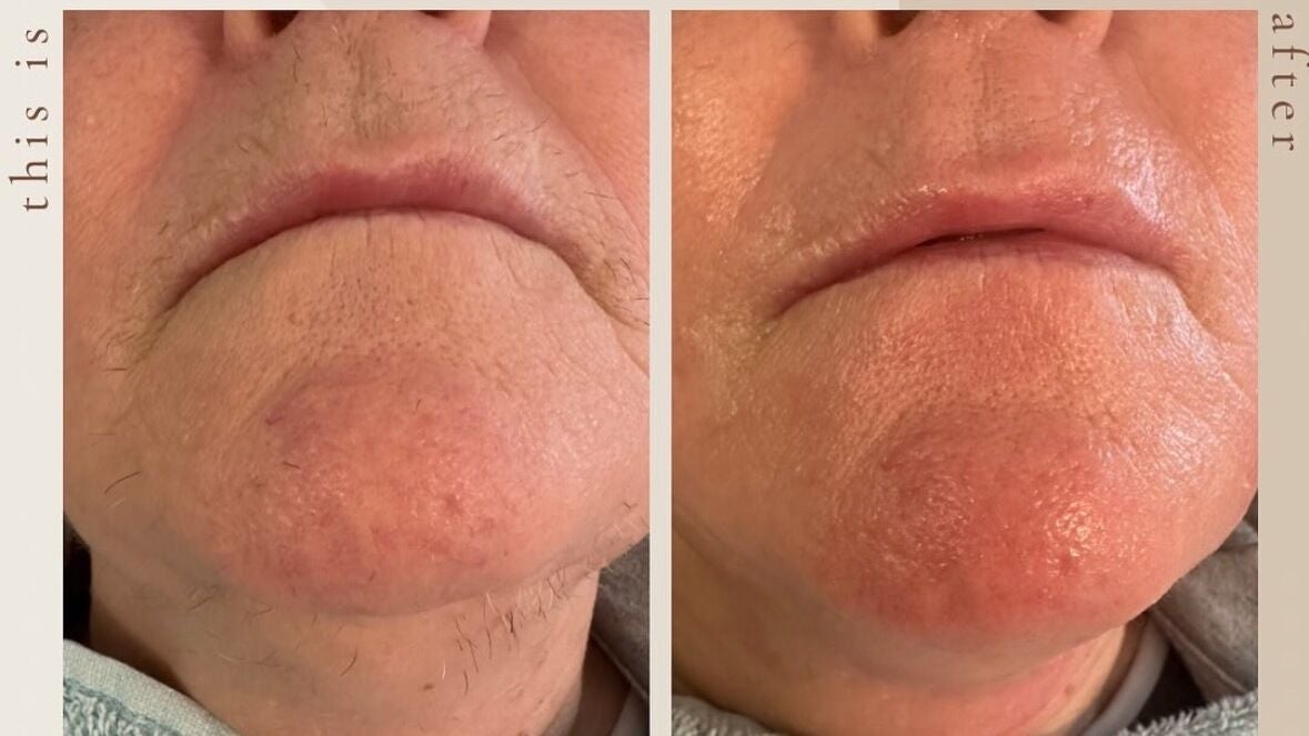 cbbc48bb-c69d-433e-a1b0-a24a467a8851-ksswaxing-im-ramsey-ramsey-fresha-9657205