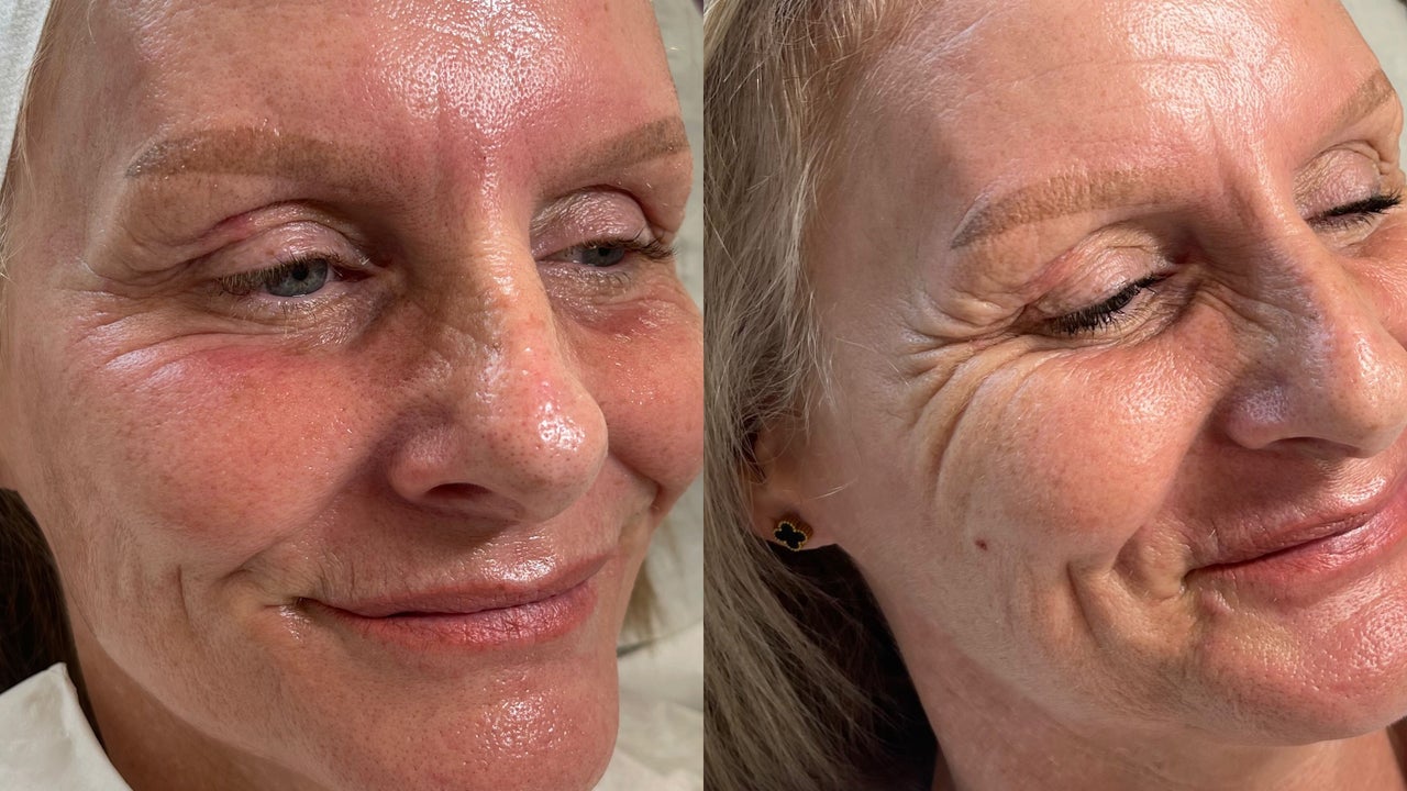 cc446a12-d9f4-4d83-a40c-12d8f84f599c-karrinacrystallpmulaestheticsskinlbeauty-gb-england-leeds-eastgarforth-fresha-6071281