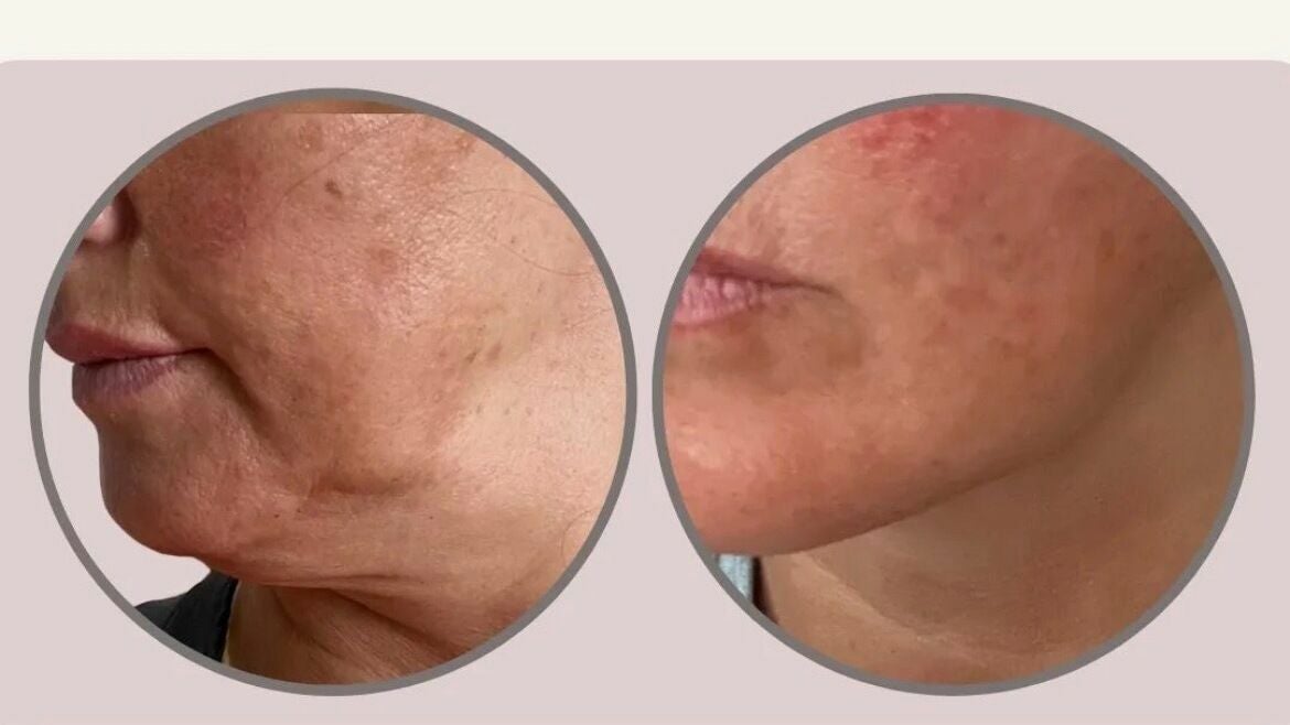 cd070ef0-ee0c-4e22-96c7-3cf73ce6fc77-freshglowaesthetics-gb-england-cheslynhay-cheslynhay-fresha-2091725