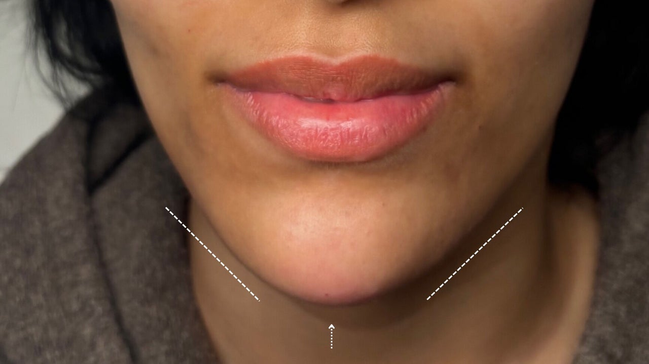 cd208657-81af-44b8-ac51-70dcb5d63665-advancedcosmeticsbyshannen-gb-england-southampton-fresha-3147455