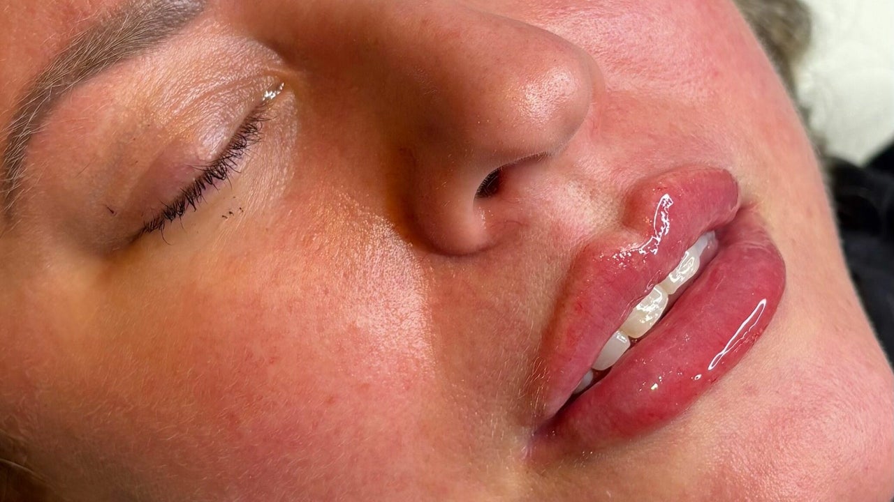 ce5f93d6-b9bb-4340-aacb-b2a3ca2b005e-greenhouseaesthetics-gb-england-sevenoaks-fresha-4170066