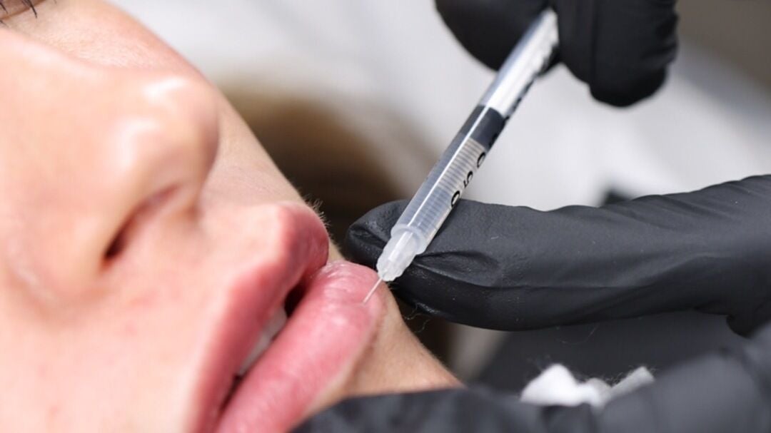 cec2ed65-5f82-4318-aea7-ee21d9803aaa-impeccableaesthetics-gb-england-warrington-stocktonheath-fresha-2000600