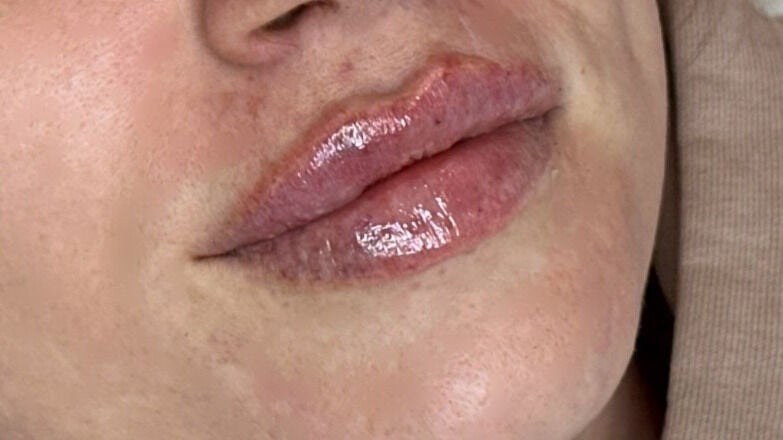 d0629ef9-a4f0-4246-9363-fc58639e9d35-tmbeautyandaesthetics-gb-wales-caldicot-fresha-9212189