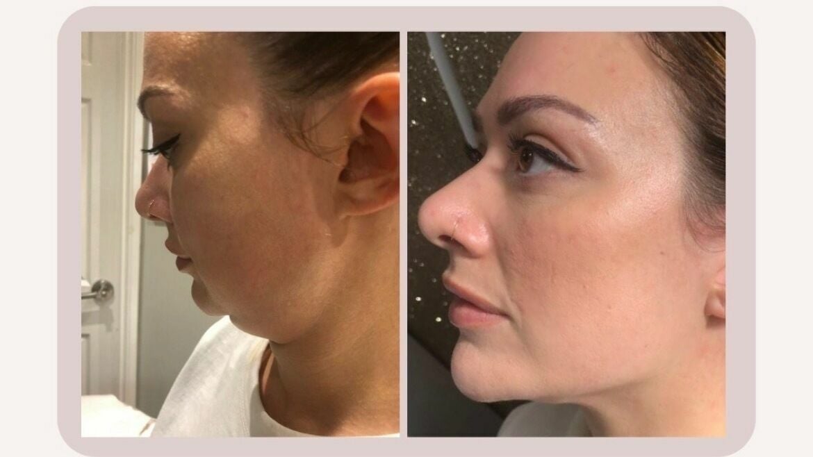 d1c48728-3c47-4023-b9a7-c0c7cb7ab084-freshglowaesthetics-gb-england-cheslynhay-cheslynhay-fresha-4047704