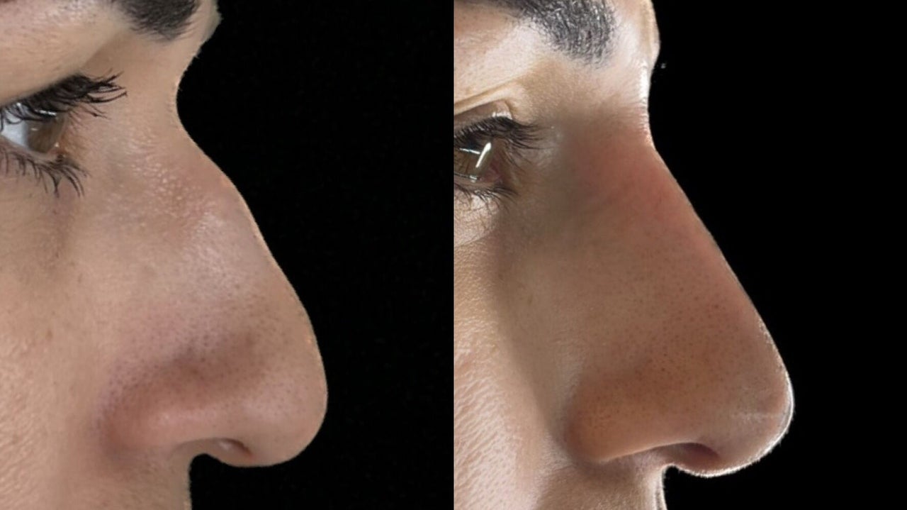 d30a6d4c-fcfe-4855-98b1-a257d9844bc9-ajaestheticslounge-gb-england-paddockwood-fresha-2347297