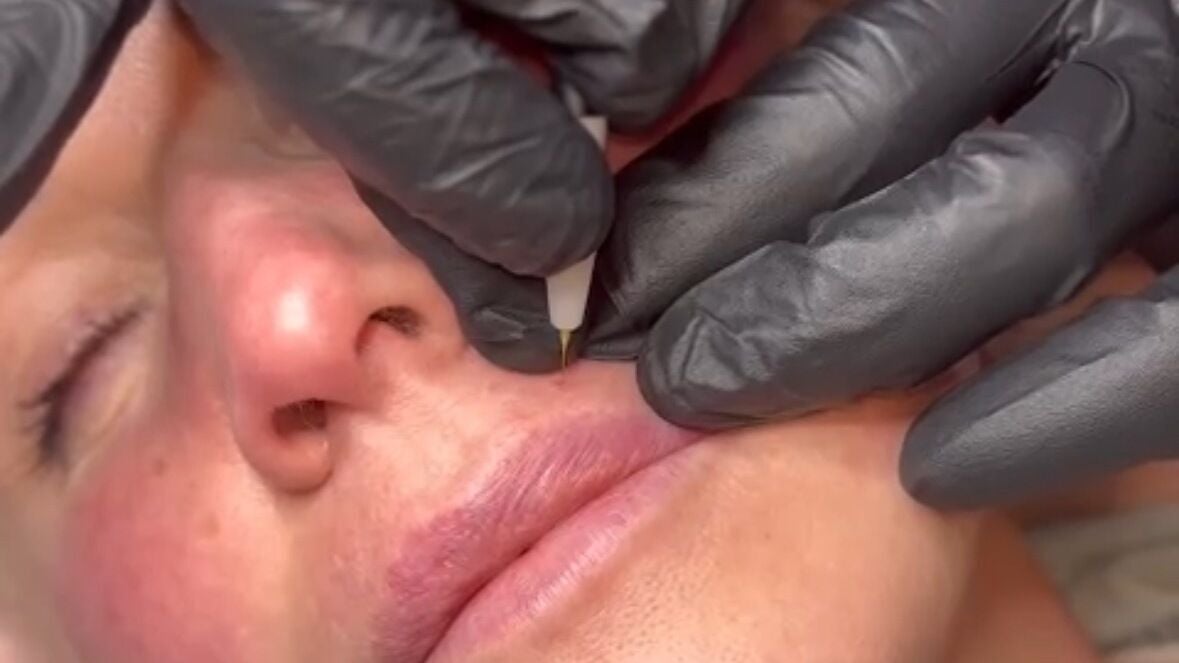 d32813e5-641e-49be-8ac8-db3cab2f5d03-carynfoweradvancedskintherapy-gb-scotland-macmerry-fresha-3729245