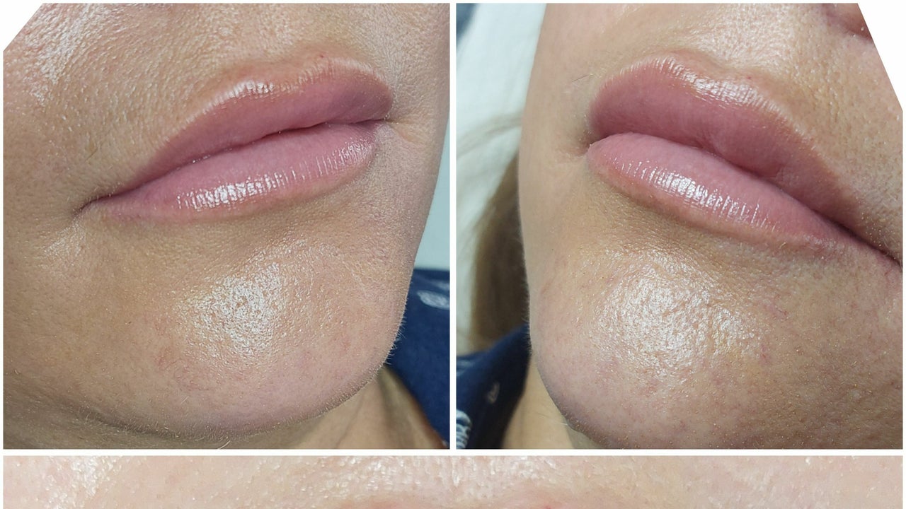 d45c181c-ef1d-4d99-99b2-cb5176e11c4b-1135494