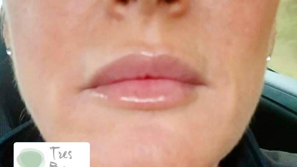 d4c7688f-c85f-4be2-979d-558045e84436-tresbeauxaesthetics-gb-england-birmingham-kingsnorton-fresha-7626175