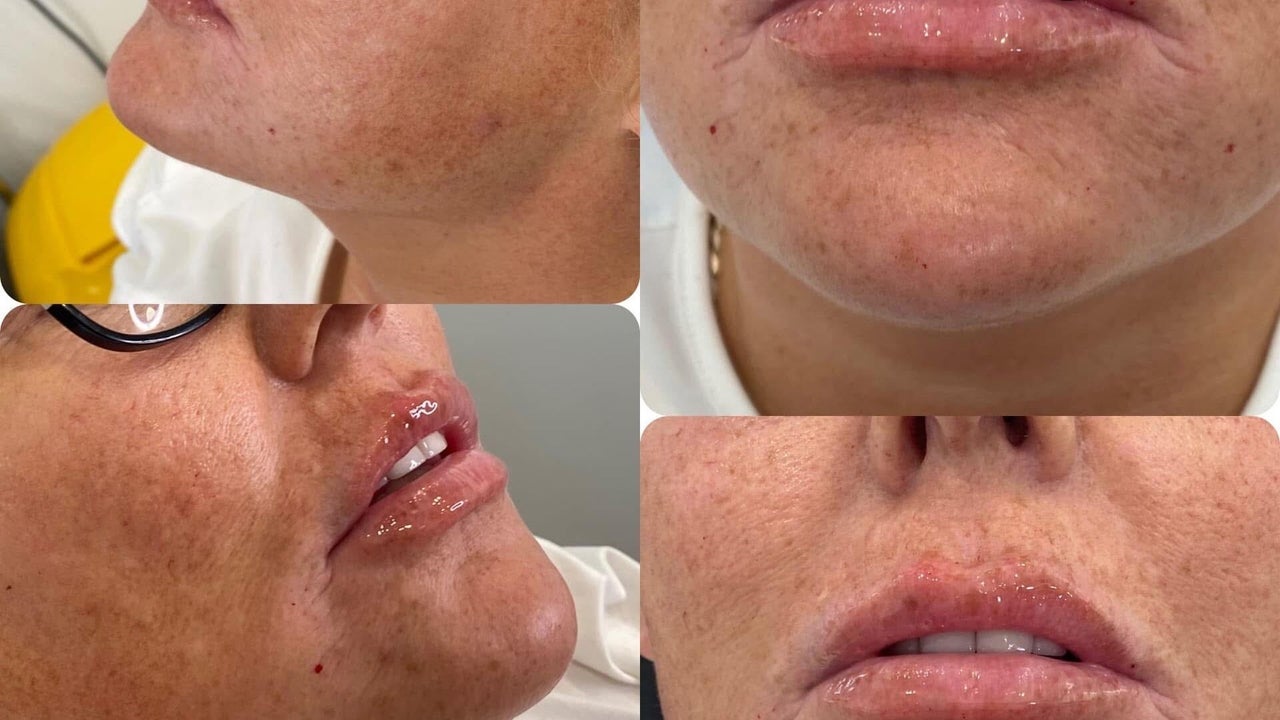 dc0b8307-f1f1-4267-a8fb-9f179c3aacd4-mbglow-gb-england-fleetwood-fresha-4076353