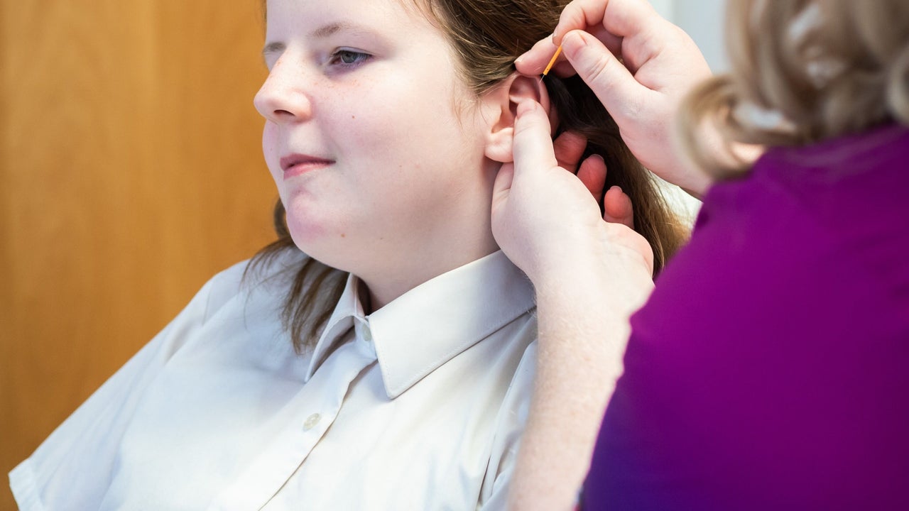 dc7bb31c-51fb-4330-ba47-8b9328cb0153-deannathomasacupuncturewellbeing-gb-england-middlesbrough-acklam-fresha-1488323