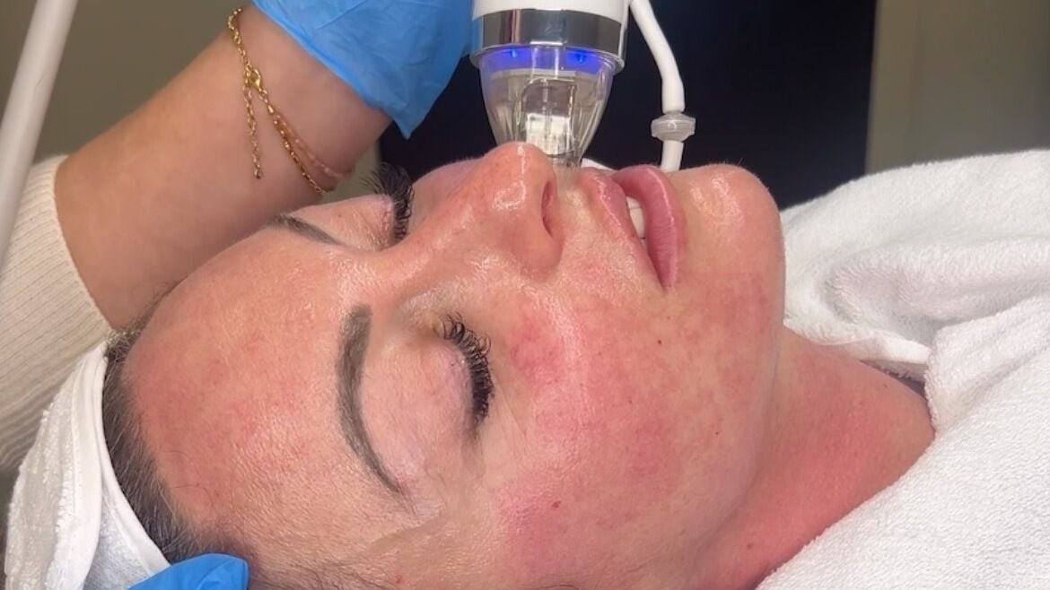 dca8d1eb-6eef-42c9-ba2f-55de9a33820c-ldrskinclinic-gb-england-harrogate-northyorkshire-fresha-1607581