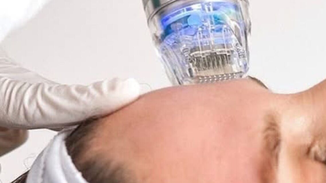 df4db056-4839-4a72-a5c9-d84e03457b49-ldrskinclinic-gb-england-harrogate-northyorkshire-fresha-7831476