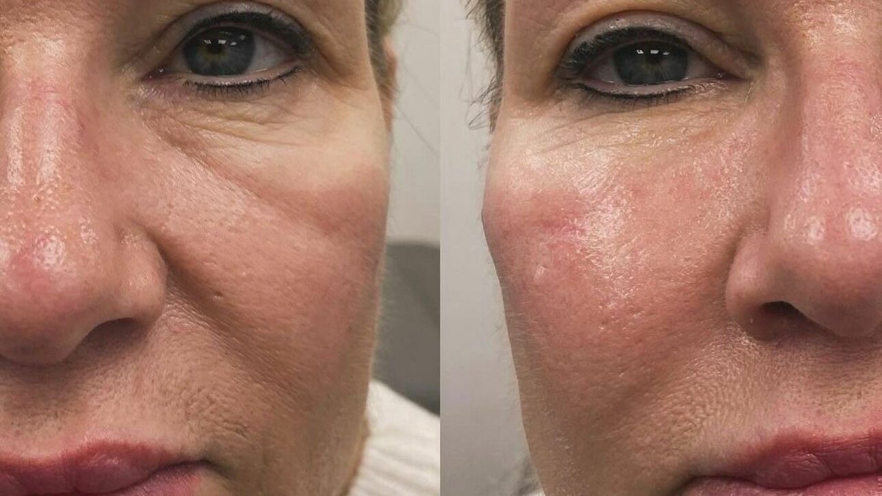 dffe0b72-d6e4-46c3-a465-3313a6a46668-debutaestheticsclinic-gb-england-wickford-fresha-9802196