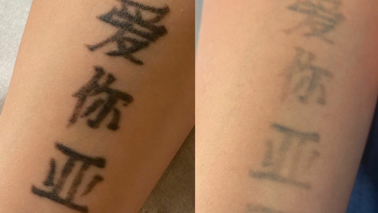 e02ef473-f041-42c7-8215-69abf7b07e71-rachelberrypmulaserandcosmetictattoo-gb-england-huddersfield-aspley-fresha-3970558