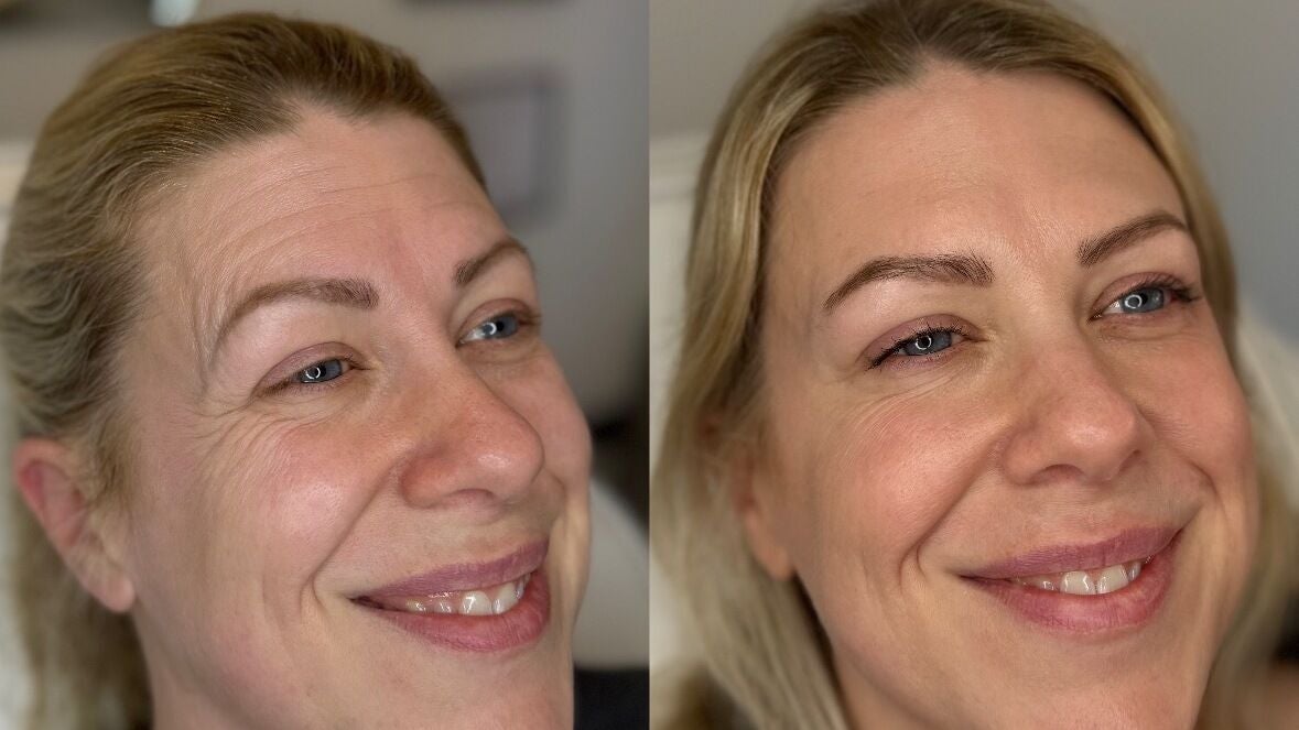 e4374fd9-060a-401d-8be1-cbc2d842e60f-theaesthetictouch-gb-england-colchester-fresha-1345464