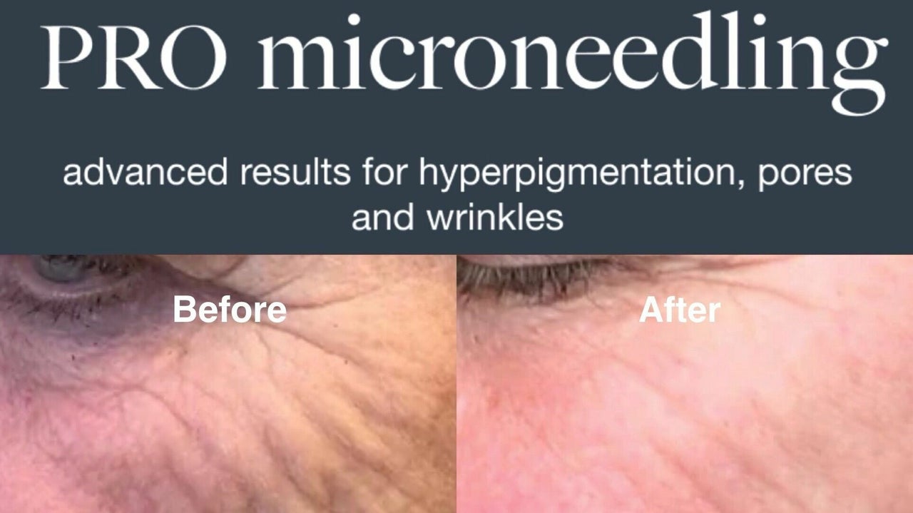 eafb4ff2-8400-4433-a4f4-f597149cc2c9-absolutebeauty-gb-england-northampton-duston-fresha-6705866