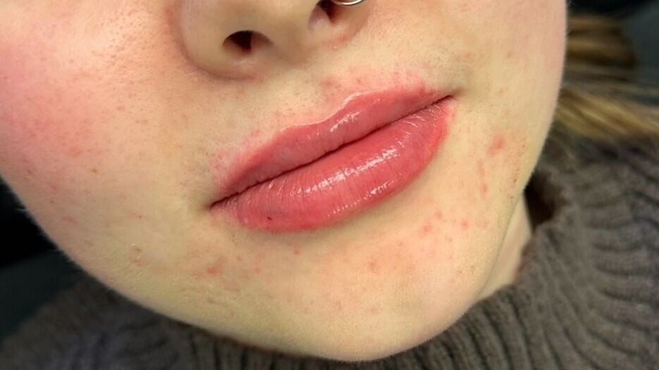 ec8e0d32-7b9e-40cb-b4b7-77e0f04a3356-anatomicaaestheticsamyyoungbscfdscbieassoc-gb-scotland-glasgow-dalmarnock-fresha-8938277