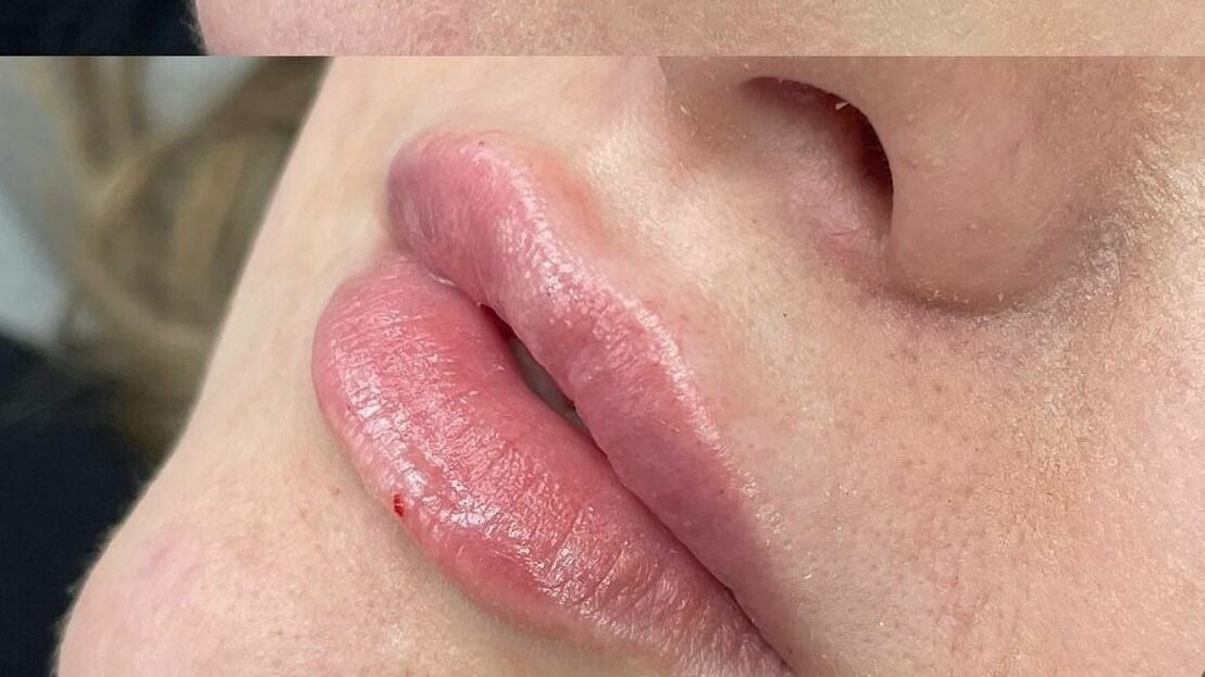 ef77492f-12c8-463d-b260-40b48eb20cdc-debutaestheticsclinic-gb-england-wickford-fresha-3121988