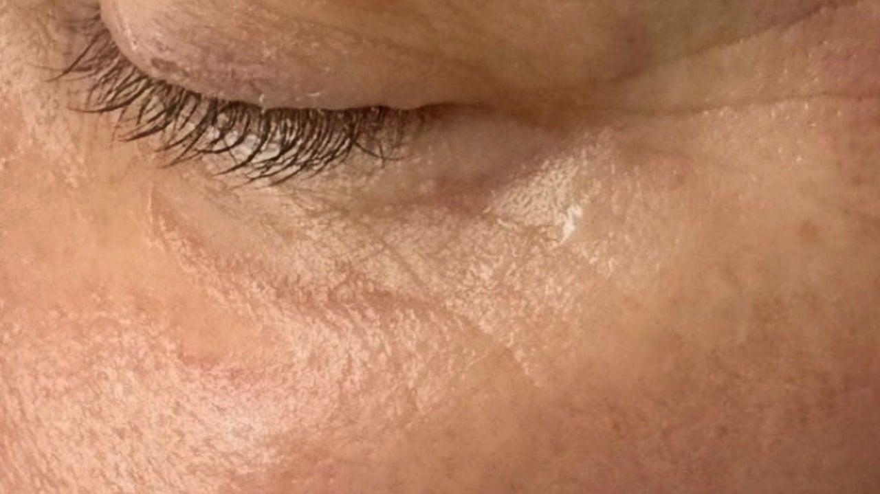 f2af455f-6315-43ec-9a61-e4bb31fa7455-anatomicaaesthetics-gb-scotland-glasgow-rutherglen-fresha-4648570