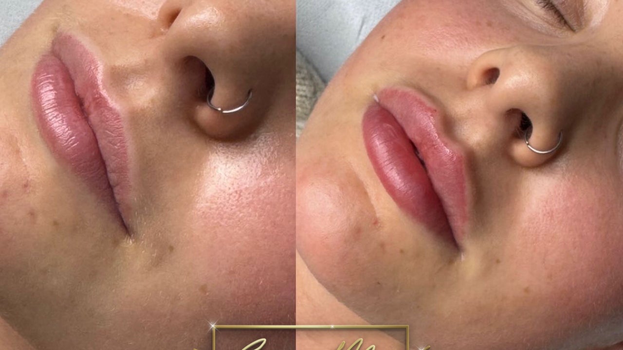 f307f380-43d6-44ed-923b-5d9e8901532e-envymeaestheticsbeauty-gb-england-scunthorpe-fresha-2604758