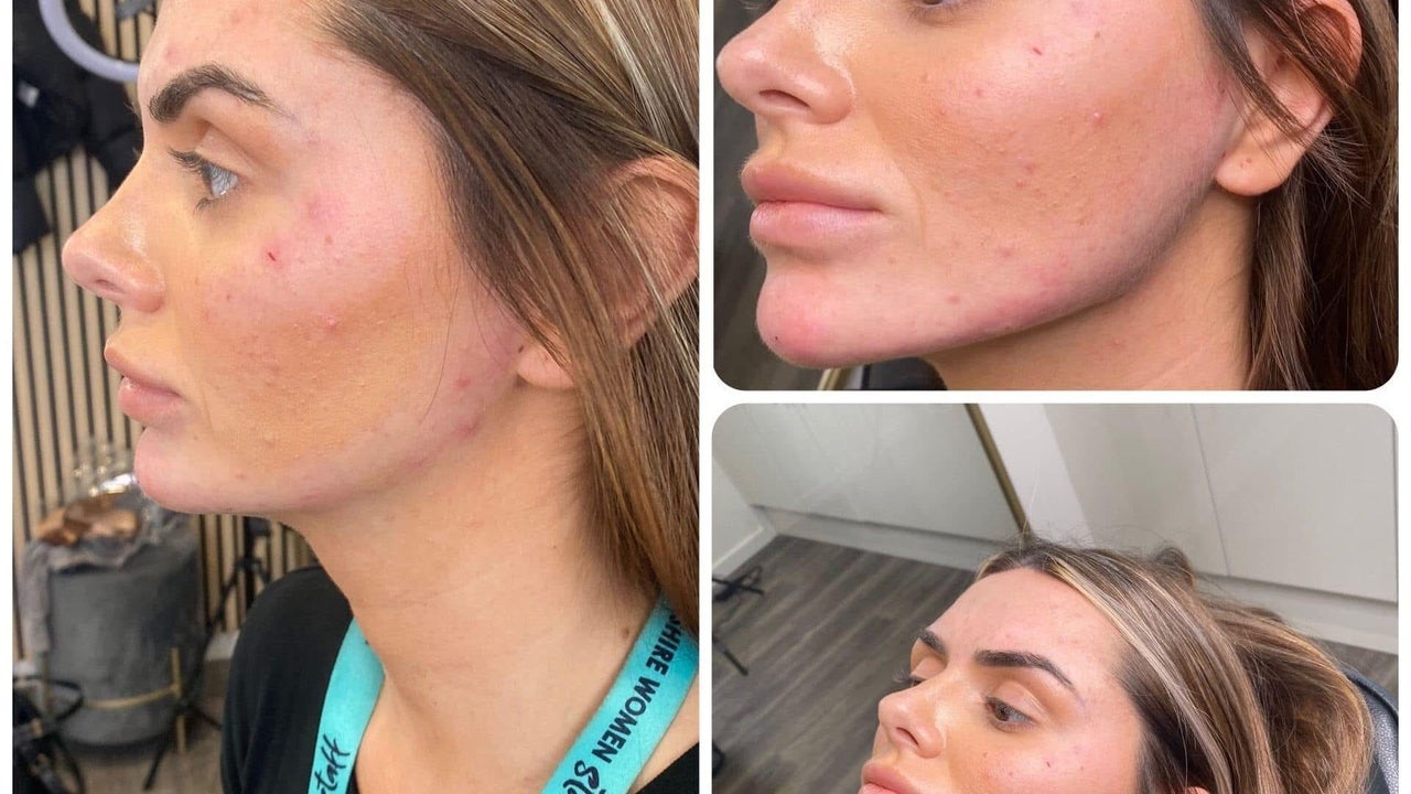 f352a49e-4213-4545-8634-81a47db2500a-mbglow-gb-england-fleetwood-fresha-6656916